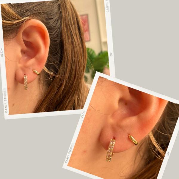 ARETES